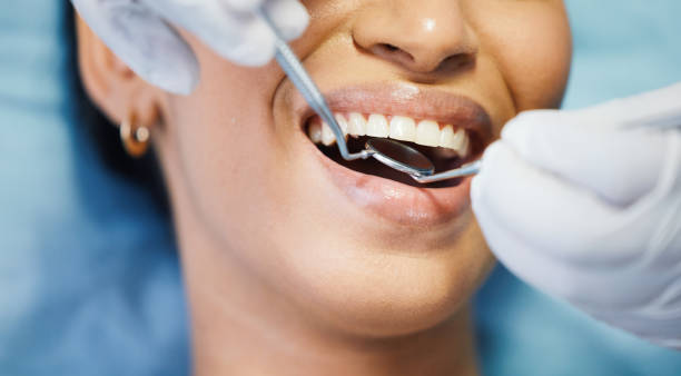Best Mobile Emergency Dentist in Iona, FL